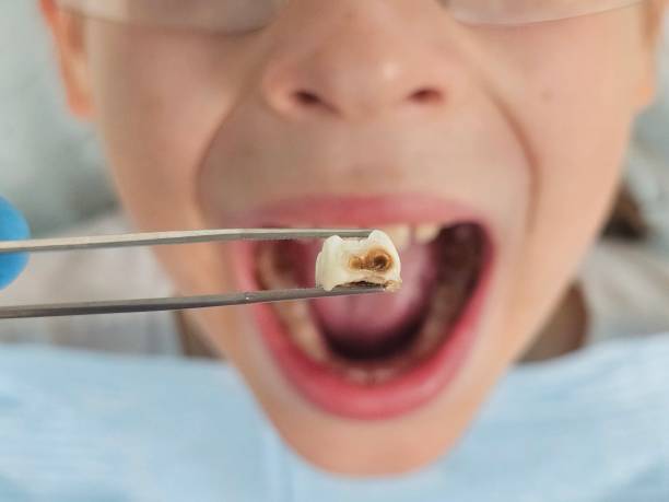 Best Broken or Cracked Tooth Emergency Dentist in Salton City, CA